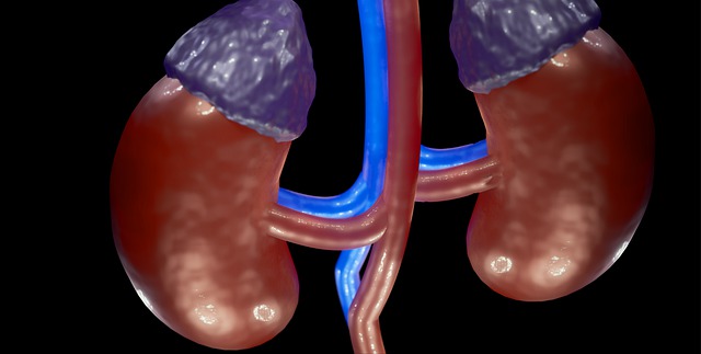 are kidney stones genetic