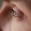 Over Masturabation Side Effects On Eyes